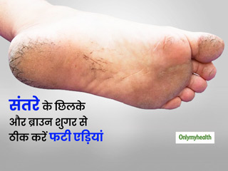 फटी एड़ियों को ठीक करेगा संतरे के छिलके और ब्राउन शुगर का स्क्रब, एक्सपर्ट से जानें स्क्रब बनाने का तरीका 